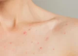 Gesundes Hautbild bei hormonellen Veränderungen