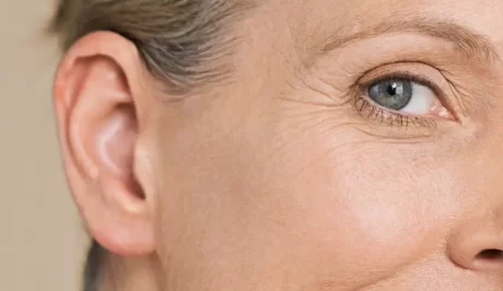 Falten um die Augen